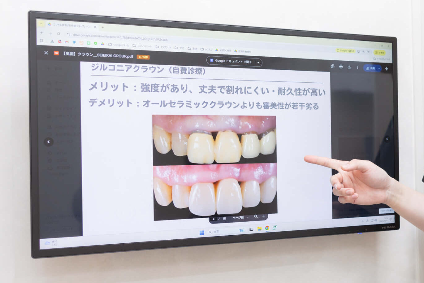 診療用モニター